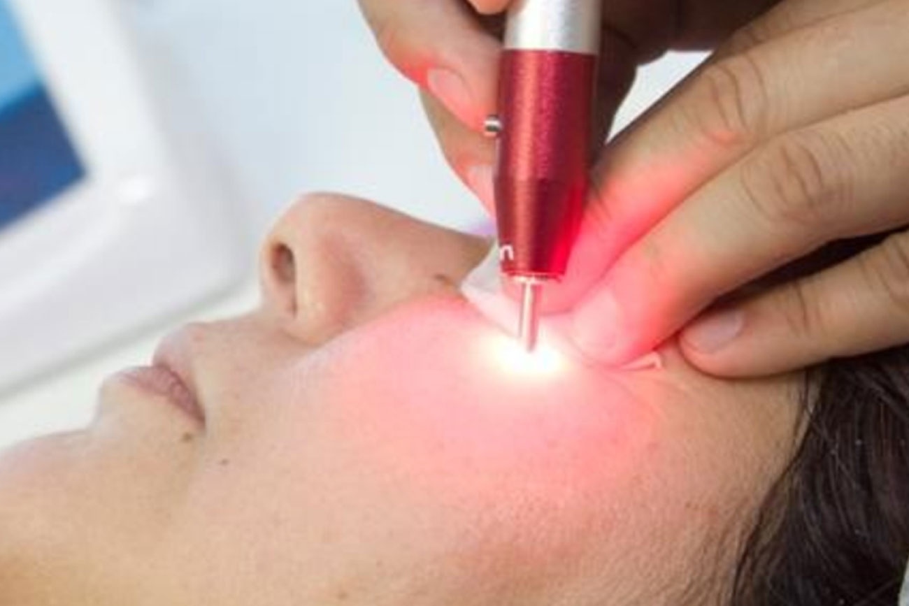 Curso de Fototerapia Laser e LED na Estética Facial e Corporal Sympla