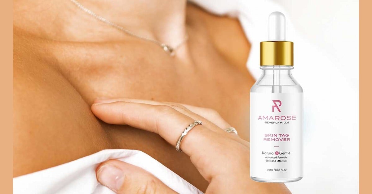 Amarose Skin Tag Remover em Brasília - Sympla