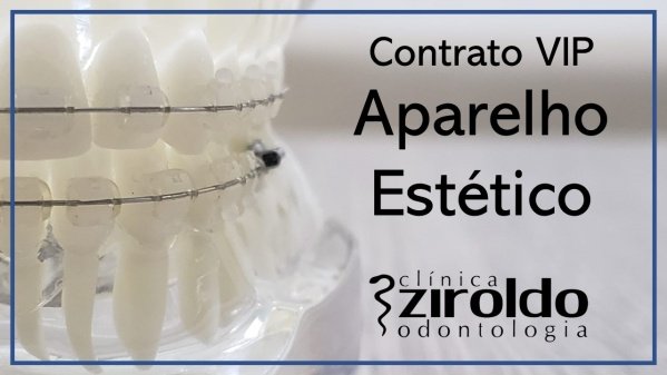 Contrato VIP - Ortodontia Estético - Clínica Ziroldo em Santo André ...