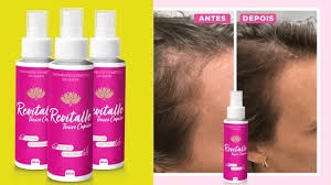 Revitalle Tônico Capilar: Supere a Queda de Cabelo com Este Tratamento Natural