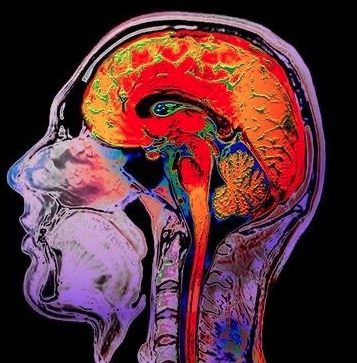 Imagem do evento Simpósio de Radiologia e Diagnóstico por Imagem- Achados Radiológicos nos Exames de Cabeça e Pescoço
