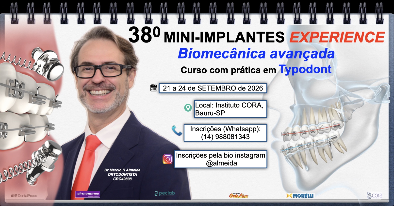 38 Curso Mini-Implantes EXPERIENCE: Biomecânica Avançada ( somente TAXA DE INSCRIÇÃO)